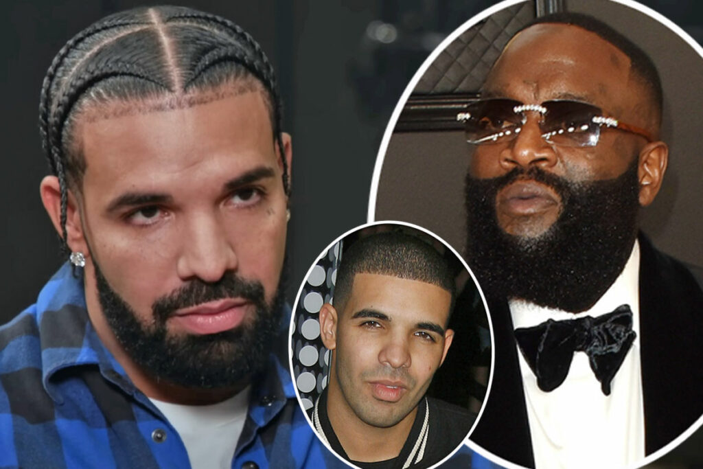 Did Drake Get A Nose Job?! Rick Ross Says So! – Perez Hilton