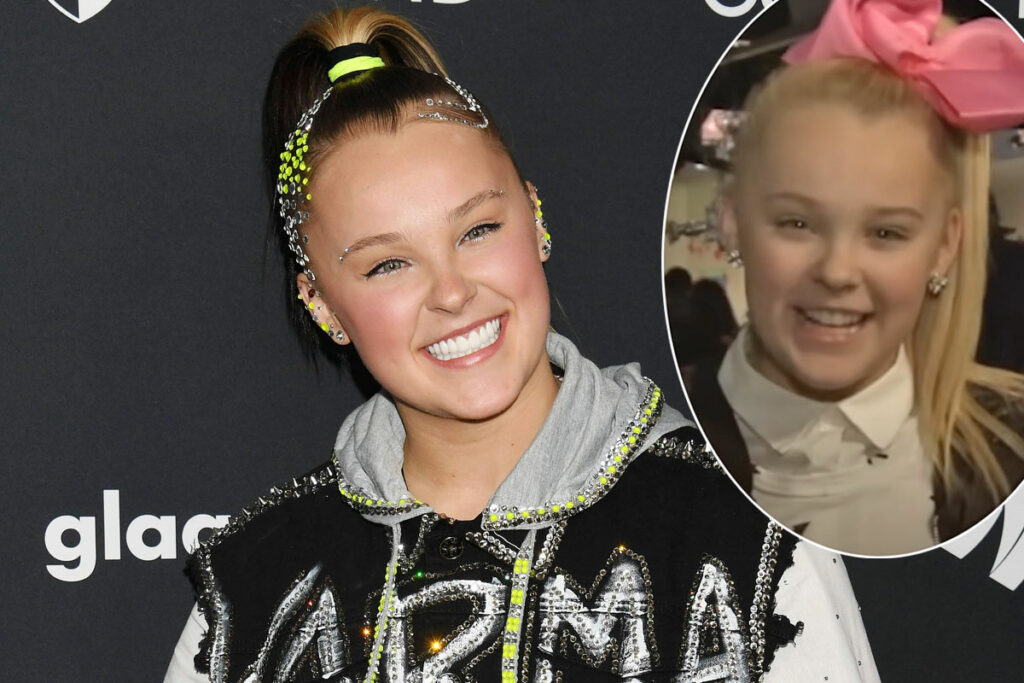 JoJo Siwa Spent $50K On THIS Cosmetic Procedure! Can You Even Tell?? – Perez Hilton